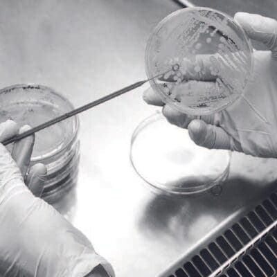 Exploring the Relationship Between the Scalp Microbiome and Dandruff